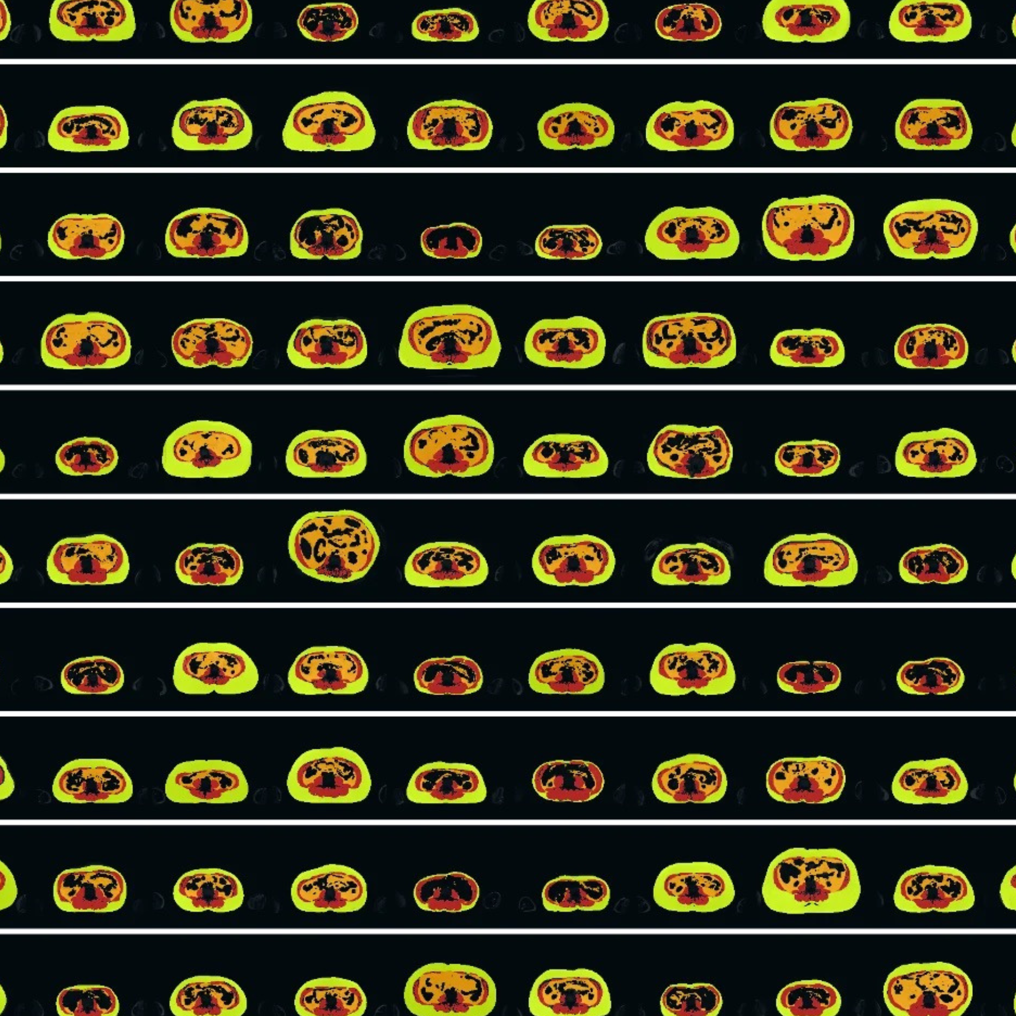 A range of yellow brain scans on a black background