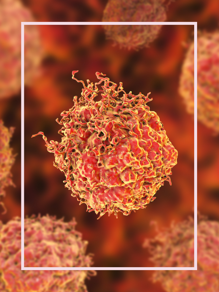 Prostate cancer cells 