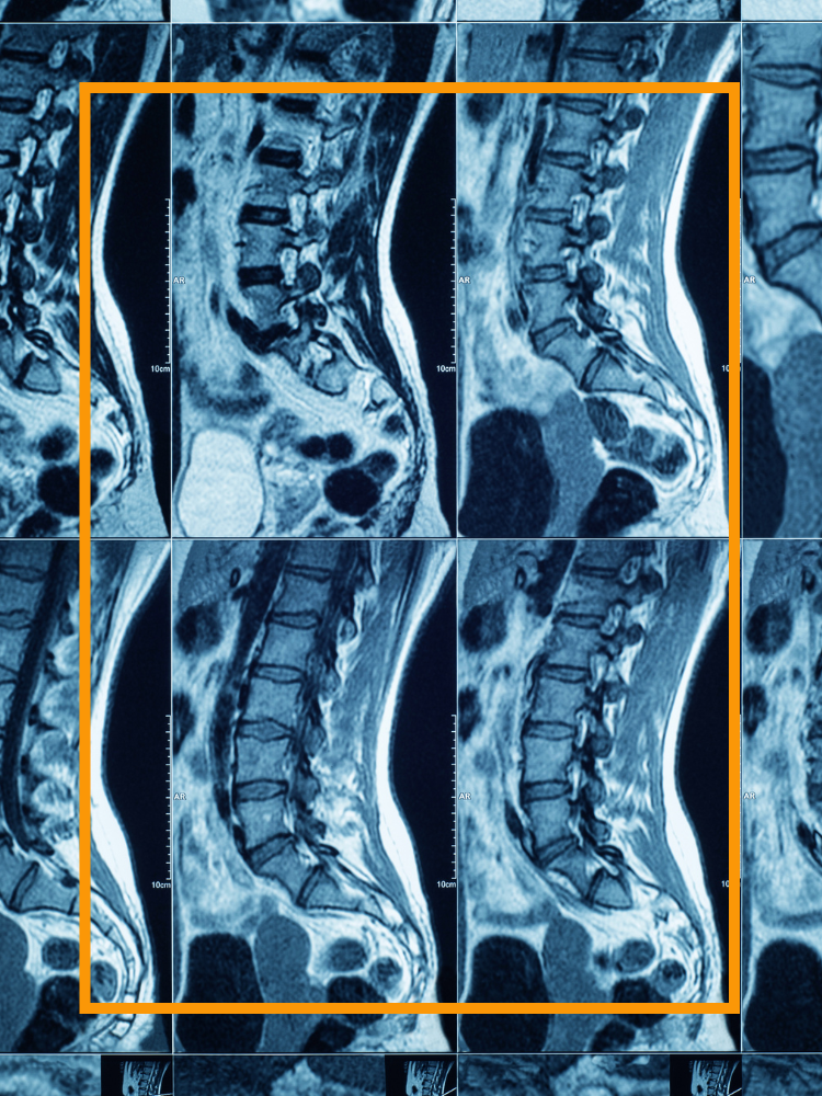 A selection of pills