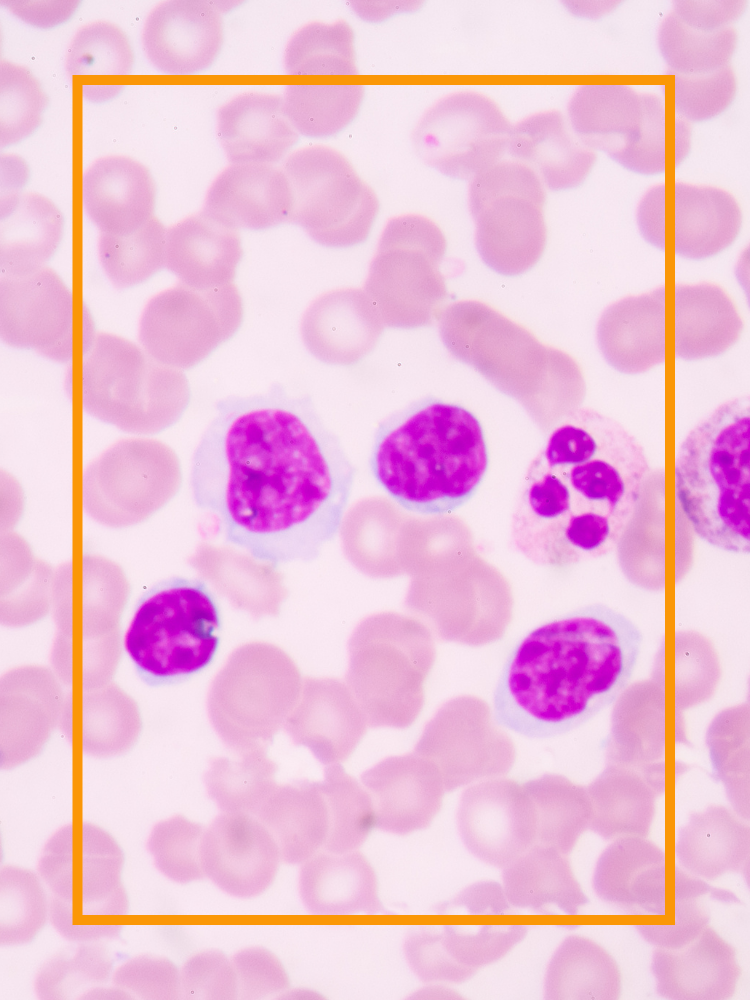 White blood cells in a smear