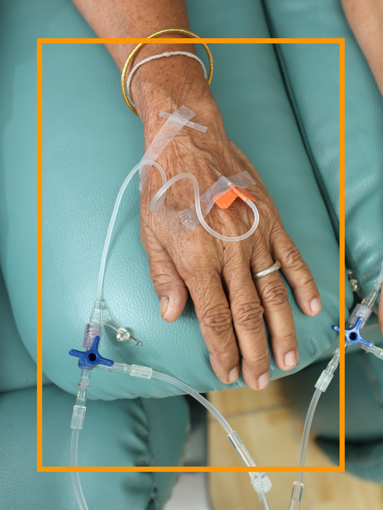 A hand with an IV attached