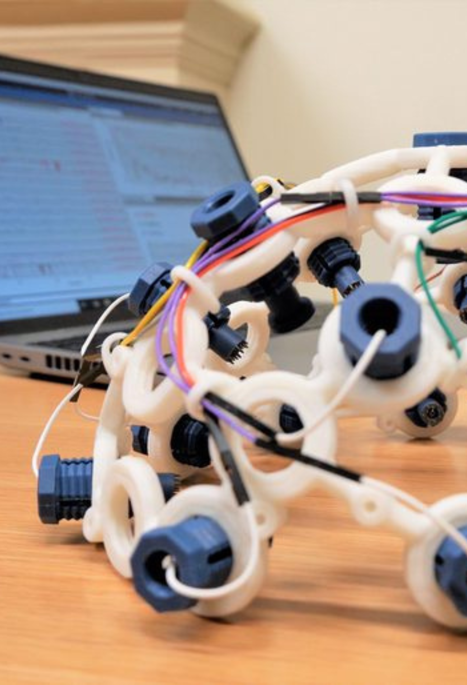 Close up of electroencephalogram (EEG) prototype