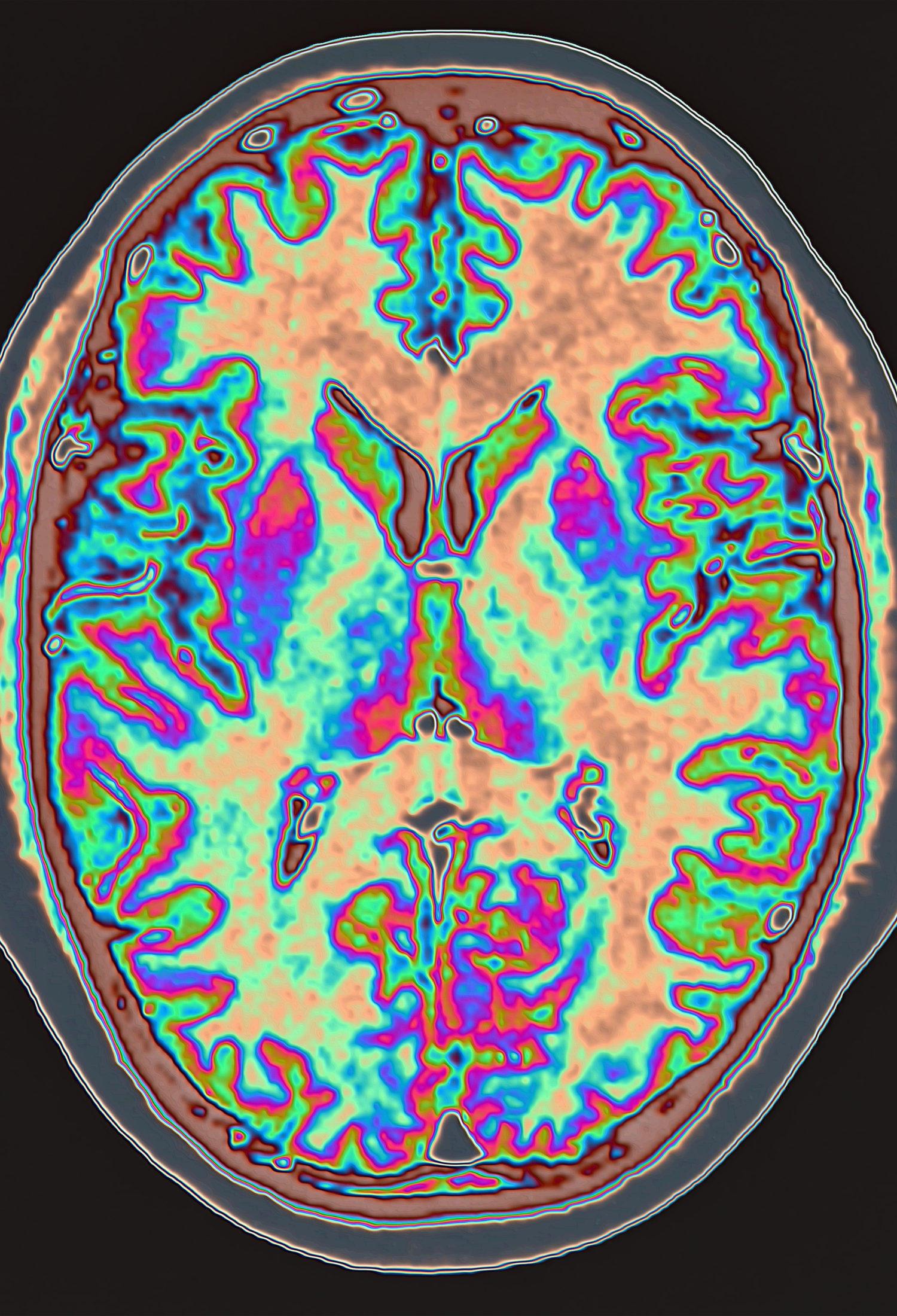 A colourful scan of the human brain