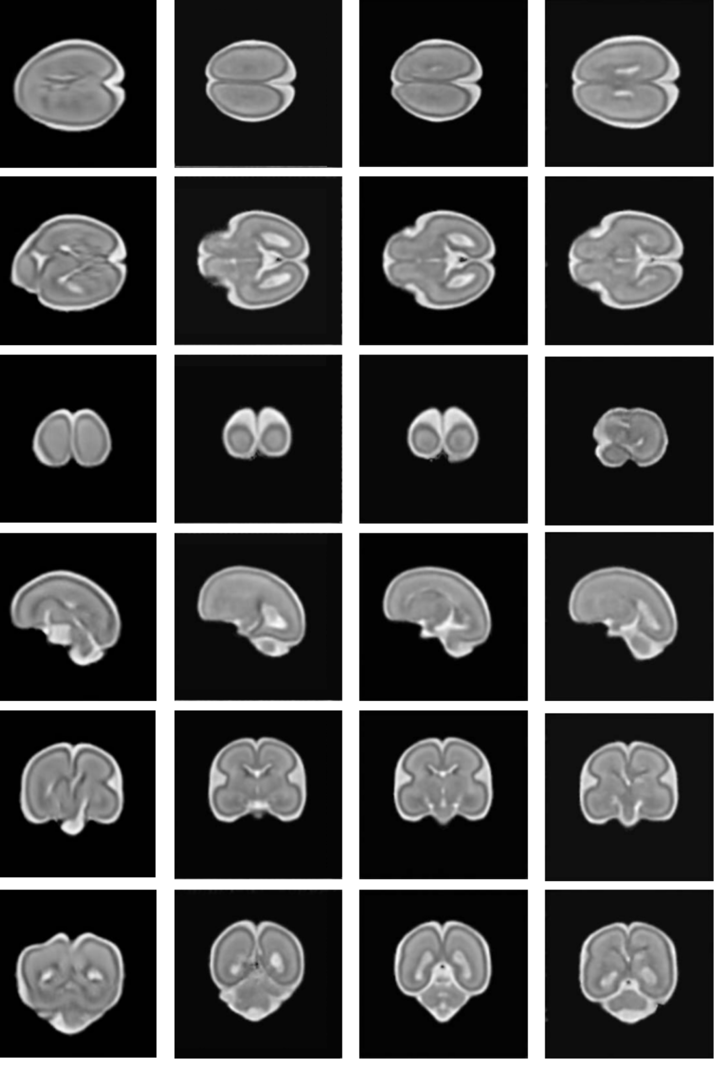 A composite image of multiple MRI scan frames